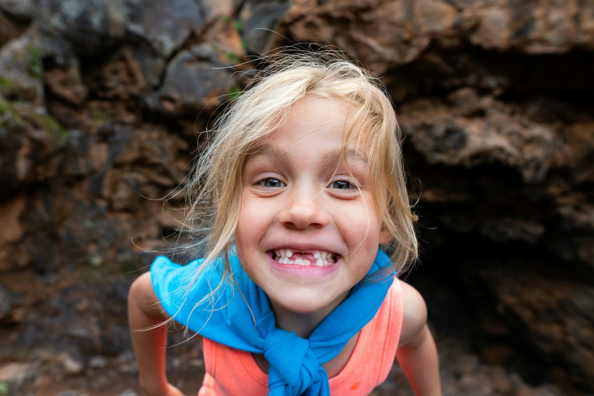 Teens’ tooth loss doubles bullying risk